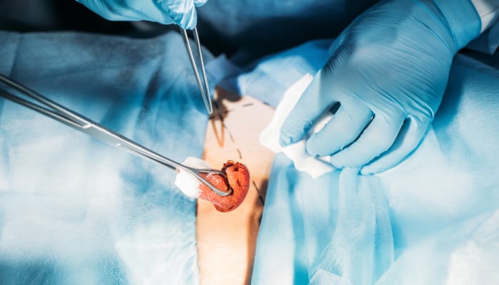 Close-up image of performing a surgery.