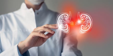 An urologist with virtual kidneys illustrate bilateral kidney tumors.