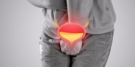 A man in pain due to bladder stones or injury.
