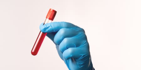 Blood sample to test for penile cancer.
