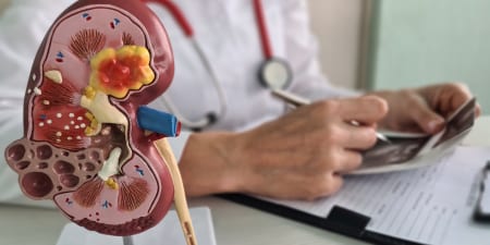 A model of a chronically infected kidney and an urologist with diagnosis reports.