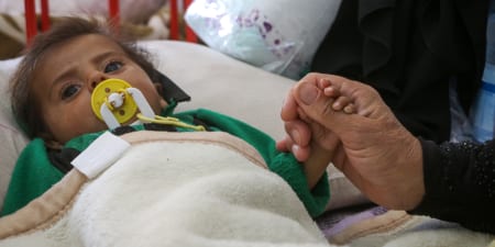 A small child suffering from congenital abnormalities.