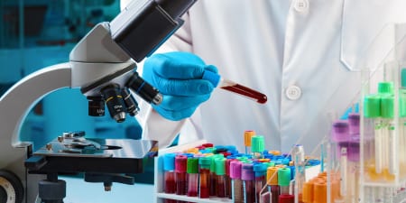 Blood samples tested in a laboratory to diagnose bladder related issues.