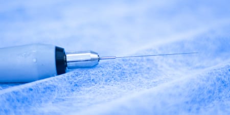 A surgical fine needle aspiration for penile cancer identification.