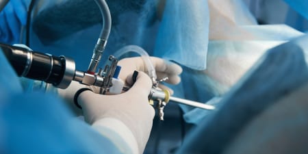 An urologist performs a fistula cystoscopy.