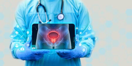 A health professional showing the display of the advanced procedures for prostate problems.