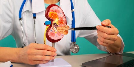An urologist explaining kidney cancer by pointing to a model of the kidney.