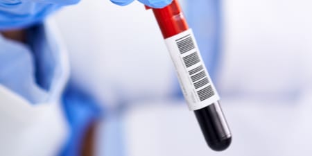 Blood samples ready to be tested for kidney cancer.