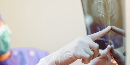 Urologists viewing a X-ray film of retrograde urethrogram(RUG).