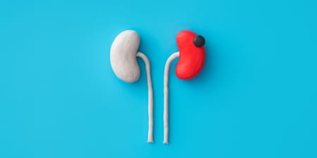 A red color model kidney is used to depict renal complications.