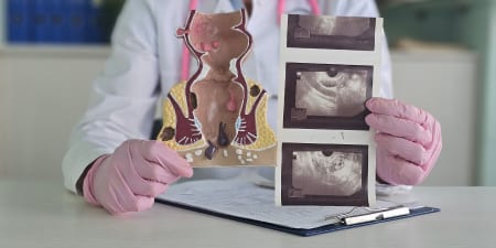 An urologist with a sectional model of prostate and TRUS results.