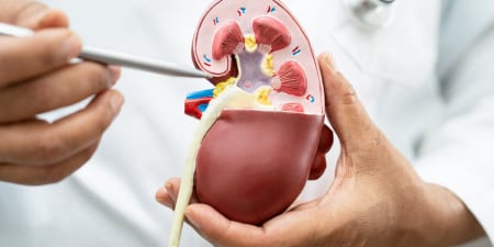 An urologist showing the model of kidney for ureteric stricture.