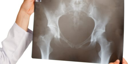 An urologist views an X-ray for urinary stones.