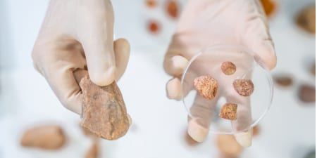 Kidney stone analysis in laboratory.