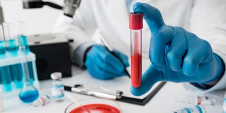 Blood sample ready for blood analysis.