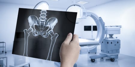 Specialized X-rays for diagnosing fistulas.