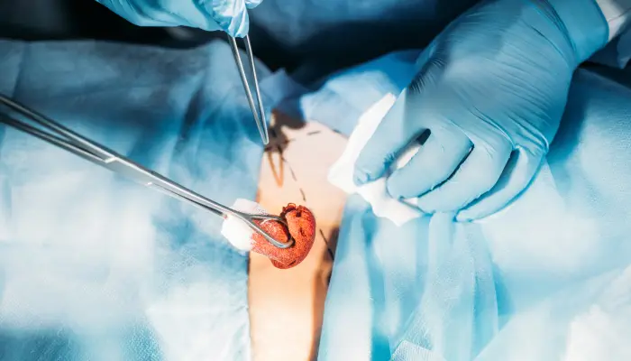 Close-up image of performing a surgery.