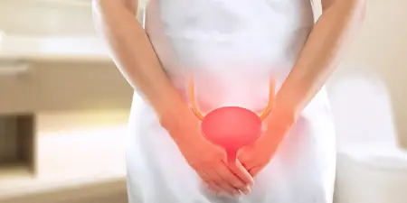 A female struggling with pain in lower abdomen due to bladder cancer.