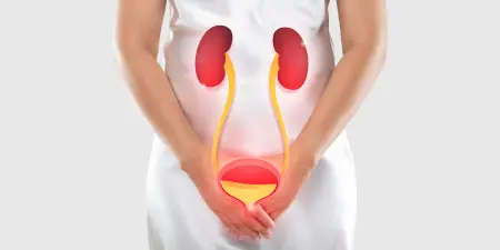A female struggling with pain in lower abdomen due to advanced pelvic cancer.