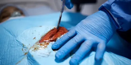 An urologist performing a surgery.
