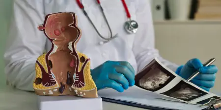 An urologist with a sectional model of prostate reviewing the scan results.