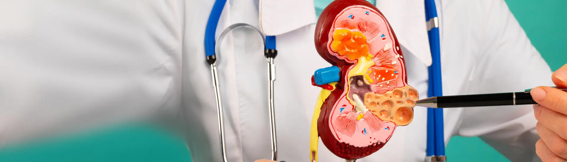 An urologist pointing to the tumor cells in a kidney model.