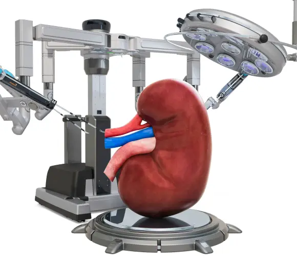 An illustration kidney under robotic assisted surgery.