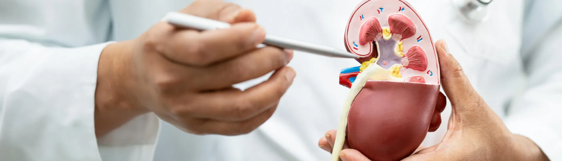 An urologist pointing to a kidney model for ureteric stricture.