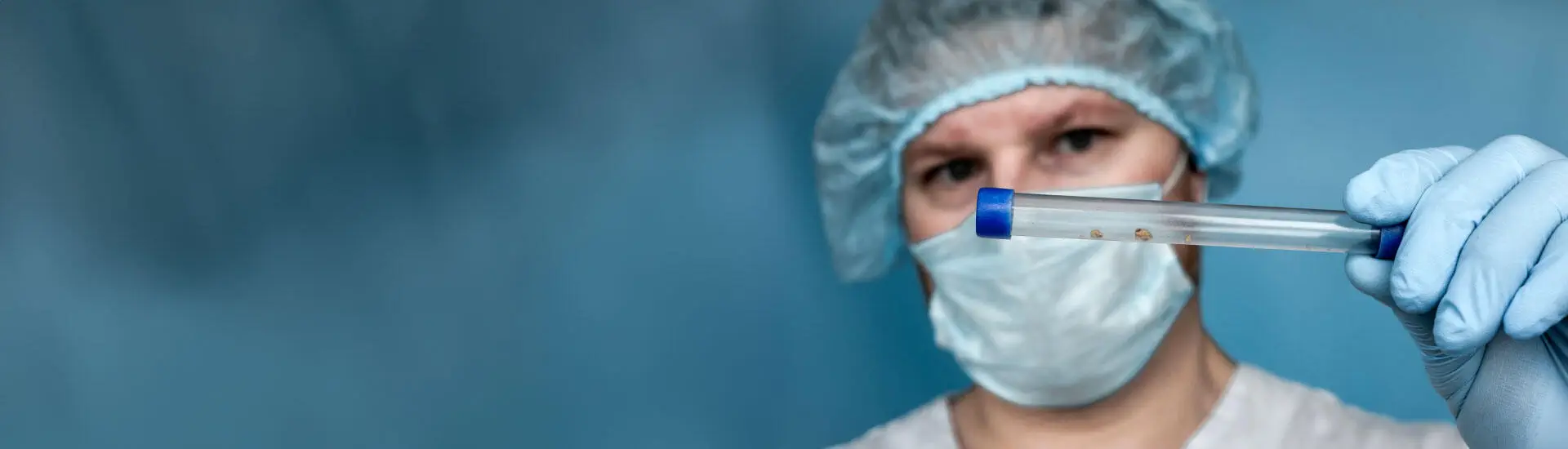 An urologist takes a look at the extracted renal calculi or stones from the kidney.