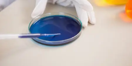 An urologist performs dye test for vaginal fistula.