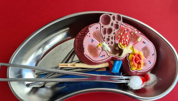 A model of kidney with surgical tools illustrate robotic adrenalectomy surgery.