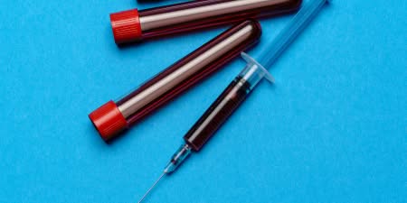 Blood samples illustrate the blood tests for prostate issues.