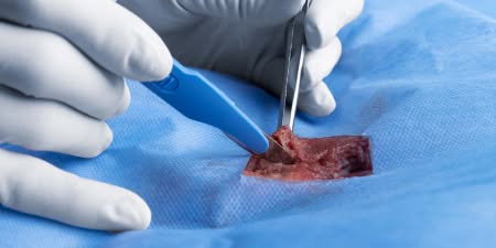 A procedure for identifying tissue defects.